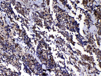 Ran Rabbit Polyclonal Antibody