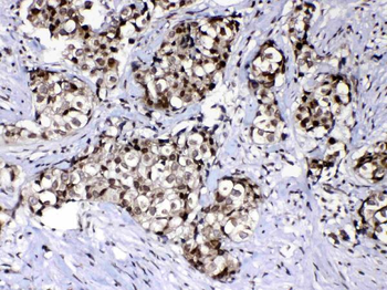 Ran Rabbit Polyclonal Antibody