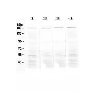 Angiotensin Converting Enzyme 1/Ace Rabbit Polyclonal Antibody