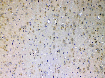ErbB 4/ERBB4 Rabbit Polyclonal Antibody