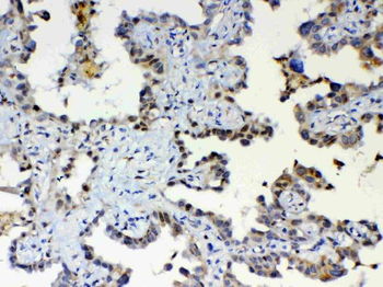 ETV6/Tel Rabbit Polyclonal Antibody