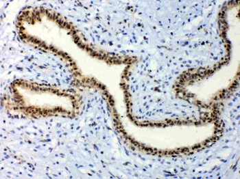 ETV6/Tel Rabbit Polyclonal Antibody