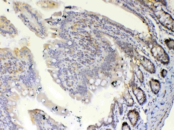 ETV6/Tel Rabbit Polyclonal Antibody