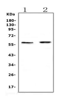 ETV6/Tel Rabbit Polyclonal Antibody