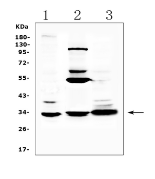ERCC1 Rabbit Polyclonal Antibody