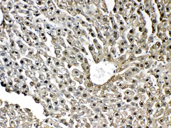 GST3/GST pi/Gstp1 Rabbit Polyclonal Antibody