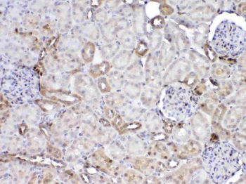 GST3/GST pi/Gstp1 Rabbit Polyclonal Antibody
