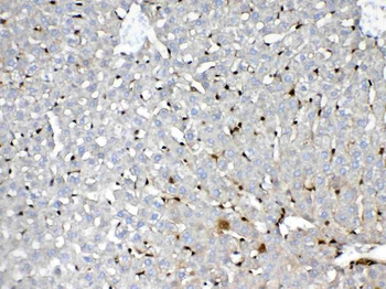 GST3/GST pi/Gstp1 Rabbit Polyclonal Antibody