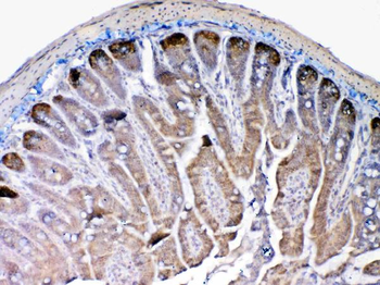 MMP13 Rabbit Polyclonal Antibody