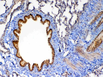 MMP13 Rabbit Polyclonal Antibody