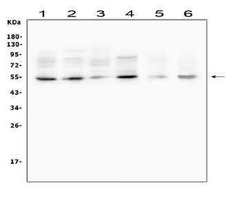 MMP13 Rabbit Polyclonal Antibody