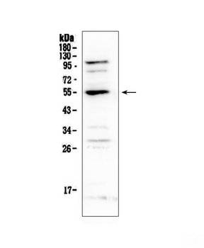 EPO Receptor/EPOR Rabbit Polyclonal Antibody