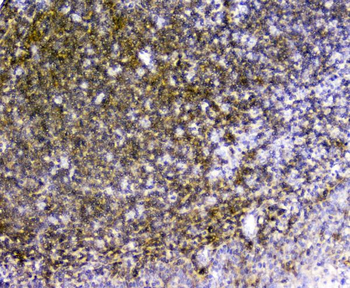 TRAIL/TNFSF10 Rabbit Polyclonal Antibody