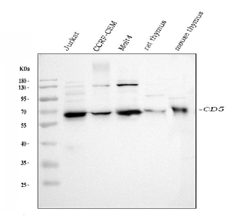 CD5 Rabbit Polyclonal Antibody