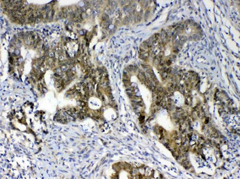 GALE Rabbit Polyclonal Antibody