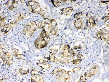 GALE Rabbit Polyclonal Antibody