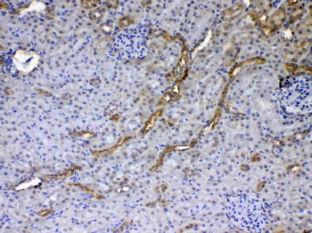 GALE Rabbit Polyclonal Antibody