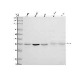 GALE Rabbit Polyclonal Antibody