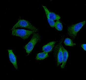 GSTM1 Rabbit Polyclonal Antibody