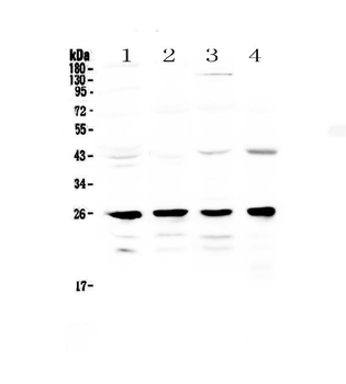 GSTM1 Rabbit Polyclonal Antibody