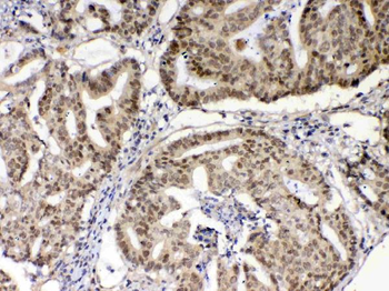 XRCC1 Rabbit Polyclonal Antibody