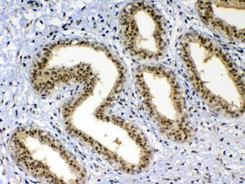 XRCC1 Rabbit Polyclonal Antibody
