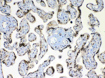 XRCC1 Rabbit Polyclonal Antibody