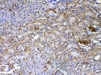XRCC1 Rabbit Polyclonal Antibody