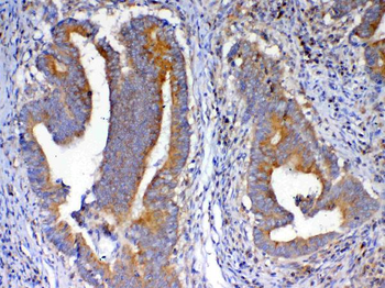 NSF Rabbit Polyclonal Antibody