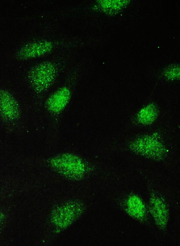PAX5 Rabbit Polyclonal Antibody
