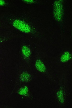 PAX5 Rabbit Polyclonal Antibody