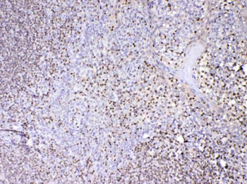 PAX5 Rabbit Polyclonal Antibody