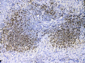 PAX5 Rabbit Polyclonal Antibody
