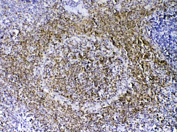 PAX5 Rabbit Polyclonal Antibody