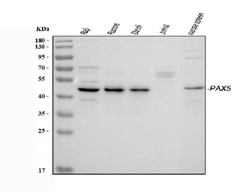 PAX5 Rabbit Polyclonal Antibody