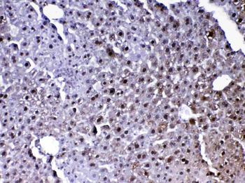 PARK7/DJ1 Rabbit Polyclonal Antibody