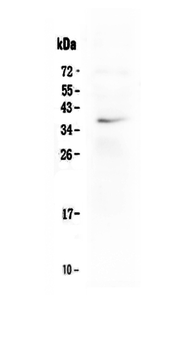 LOX-1/OLR1/LOX Rabbit Polyclonal Antibody