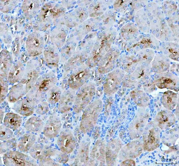 PAH Rabbit Polyclonal Antibody