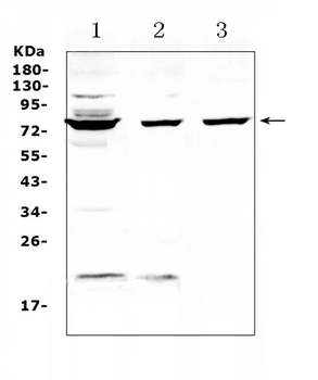 TLS/FUS Rabbit Polyclonal Antibody