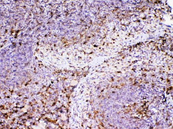 ADA Rabbit Polyclonal Antibody