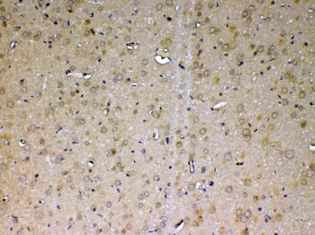 ADA Rabbit Polyclonal Antibody