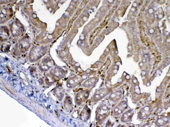 ADA Rabbit Polyclonal Antibody