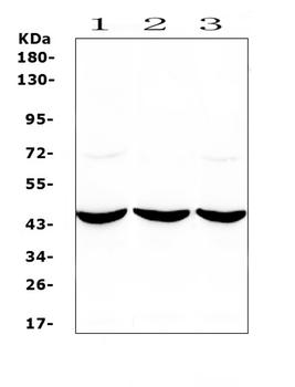 ADA Rabbit Polyclonal Antibody