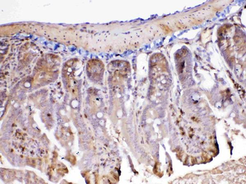 ADA Rabbit Polyclonal Antibody