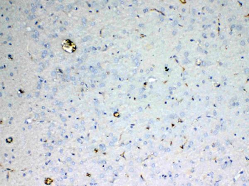 ADA Rabbit Polyclonal Antibody