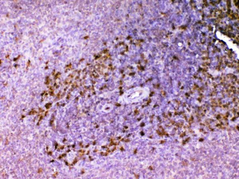 ADA Rabbit Polyclonal Antibody