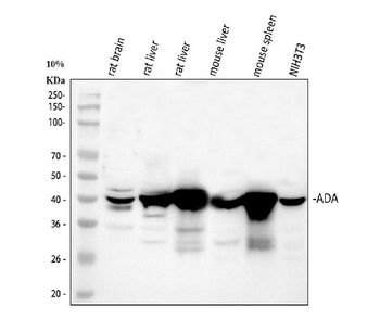 ADA Rabbit Polyclonal Antibody
