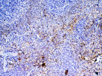 PF4 Rabbit Polyclonal Antibody
