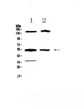 Glucokinase/GCK Rabbit Polyclonal Antibody