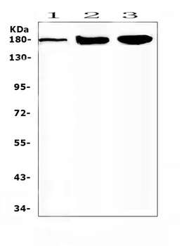 SUR1/ABCC8 Rabbit Polyclonal Antibody